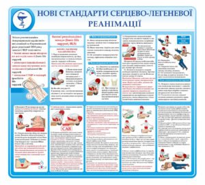 Стенд “Нові стандарти серцево-легеневої реанімації”