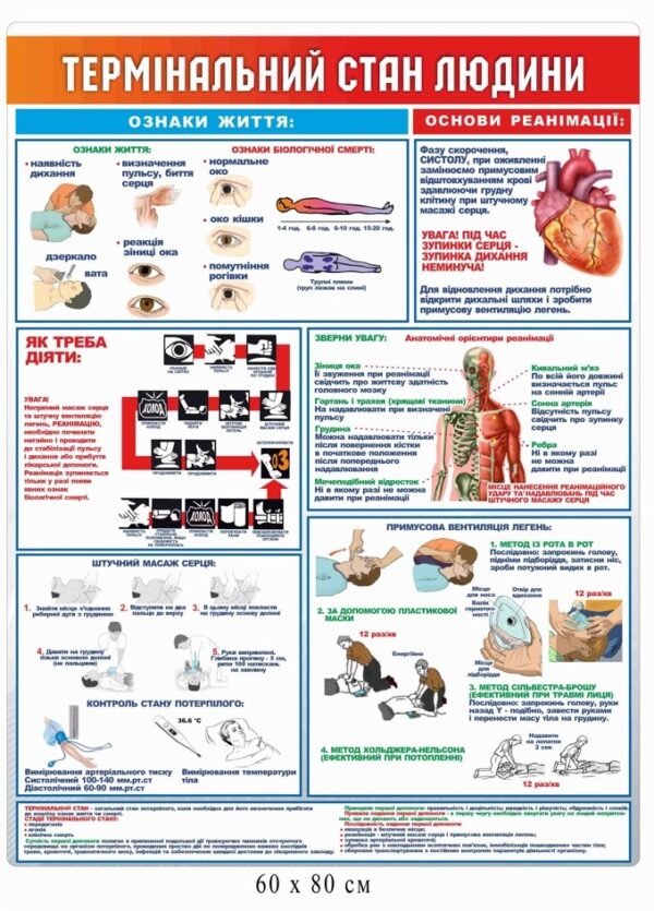 Стенд “Термінальний стан людини”